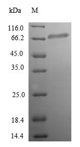 Recombinant Human Acetyl-coenzyme A synthetase 2-like, mitochondrial (ACSS1)