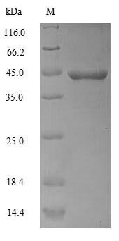 Recombinant Human Actin, alpha skeletal muscle (ACTA1), Homo sapiens (Human), E.coli, N-terminal 6xHis-tagged, 45.8kDa, purity >90% as determined by SDS-PAGE.