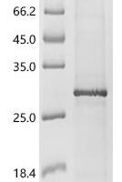 (Tris-Glycine gel) Discontinuous SDS-PAGE (reduced) with 5% enrichment gel and 15% separation gel.