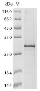 Recombinant Human Very long chain fatty acid elongase 1 (ELOVL1) Protein, Homo sapiens (Human), in vitro E.coli expression system, N-terminal 10xHis-tagged, 34.2kDa, purity >85% as determined by SDS-PAGE.