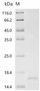 Recombinant Human Serine/threonine-protein kinase receptor R3(ACVRL1), partial