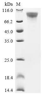 Recombinant Human Adhesion G protein-coupled receptor F5 (ADGRF5), partial, Homo sapiens (Human), Mammalian cell, C-terminal 10xHis-tagged, 39.7kDa, purity >95% as determined by SDS-PAGE.