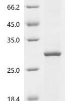 (Tris-Glycine gel) Discontinuous SDS-PAGE (reduced) with 5% enrichment gel and 15% separation gel.