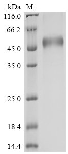 Recombinant Human Advanced glycosylation end product-specific receptor (AGER), partial
