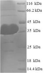 Recombinant Human Protein argonaute-2 (AGO2), partial