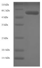 Recombinant Human Adenosylhomocysteinase (AHCY), Homo sapiens (Human), E.coli, N-terminal 6xHis-SUMO-tagged, 63.6kDa, purity >90% as determined by SDS-PAGE.
