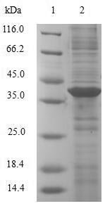 Recombinant Human Alpha-hemoglobin-stabilizing protein (AHSP), Homo sapiens (Human), E.coli, N-terminal GST-tagged, 38.8kDa, purity >90% as determined by SDS-PAGE.