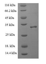 Recombinant Human Allograft inflammatory factor 1 (AIF1)
