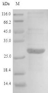 Recombinant Human Aminoacyl tRNA synthase complex-interacting multifunctional protein 2 (AIMP2), Homo sapiens (Human), E.coli, N-terminal 6xHis-tagged, 39.3kDa, purity >90% as determined by SDS-PAGE.
