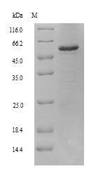 Recombinant Human Retinal dehydrogenase 2 (ALDH1A2), Homo sapiens (Human), Yeast, N-terminal 6xHis-tagged, 58.7kDa, purity >90% as determined by SDS-PAGE.