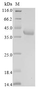 Recombinant Human Fructose-bisphosphate aldolase A (ALDOA)