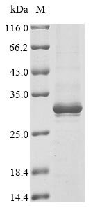 Recombinant Human Alpha-protein kinase 1 (ALPK1), partial, Homo sapiens (Human), Baculovirus, N-terminal 10xHis-tagged and C-terminal Myc-tagged, 29.9kDa, purity >85% as determined by SDS-PAGE.