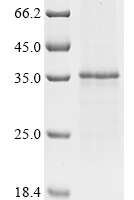 (Tris-Glycine gel) Discontinuous SDS-PAGE (reduced) with 5% enrichment gel and 15% separation gel.