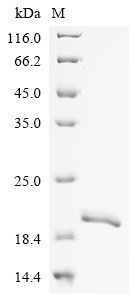 Recombinant Human Ankyrin-3 (ANK3), partial, Homo sapiens (Human), E.coli, N-terminal 6xHis-tagged, 18.6kDa, purity >90% as determined by SDS-PAGE.