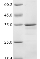 (Tris-Glycine gel) Discontinuous SDS-PAGE (reduced) with 5% enrichment gel and 15% separation gel.