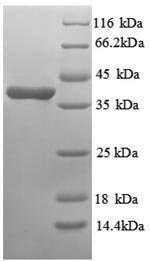 Recombinant Human Annexin A3 (ANXA3), partial