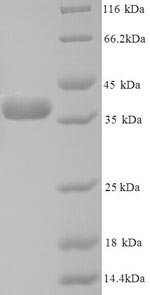 Recombinant Human Annexin A5 (ANXA5)
