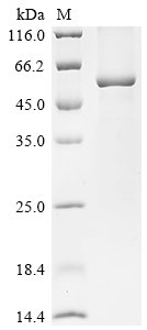 Recombinant Human Acyloxyacyl hydrolase (AOAH)