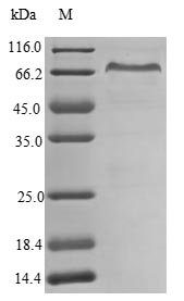 Recombinant Human Retina-specific copper amine oxidase (AOC2)