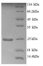 Recombinant Human Aldehyde oxidase (AOX1), partial, Homo sapiens (Human), E.coli, N-terminal 6xHis-tagged, 24.6kDa, purity >90% as determined by SDS-PAGE.