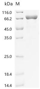 Recombinant Human AP-1 complex subunit beta-1 (AP1B1), partial, Homo sapiens (Human), E.coli, N-terminal 6xHis-tagged and C-terminal Myc-tagged, 73.3kDa, purity >85% as determined by SDS-PAGE.