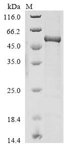 Recombinant Human AP-2 complex subunit mu (AP2M1), Homo sapiens (Human), E.coli, N-terminal 6xHis-tagged, 53.7kDa, purity >85% as determined by SDS-PAGE.