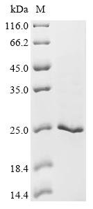 Recombinant Human AP-2 complex subunit sigma (AP2S1), Homo sapiens (Human), E.coli, C-terminal 6xHis-tagged, 23.9kDa, purity >90% as determined by SDS-PAGE.