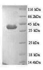Recombinant Human Apoptotic protease-activating factor 1 (APAF1), partial, Homo sapiens (Human), Yeast, N-terminal 6xHis-tagged, 37.4kDa, purity >90% as determined by SDS-PAGE.