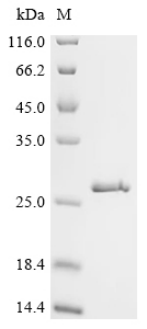 Recombinant Human Serum amyloid P-component (APCS)