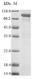 Recombinant Human Acylamino-acid-releasing enzyme (APEH), Homo sapiens (Human), E.coli, N-terminal 6xHis-tagged, 85.2kDa, purity >85% as determined by SDS-PAGE.