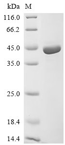 Recombinant Human Adipocyte plasma membrane-associated protein (APMAP), partial, Homo sapiens (Human), E.coli, N-terminal 10xHis-tagged and C-terminal Myc-tagged, 44.9kDa, purity >90% as determined by SDS-PAGE.