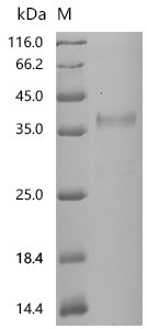 Recombinant Human Apolipoprotein E (APOE) (Active), Homo sapiens (Human), Mammalian cell, N-terminal 10xHis-tagged, 37.0kDa, purity >90% as determined by SDS-PAGE.