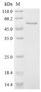 Recombinant Human DCC-interacting protein 13-alpha (APPL1), partial, Homo sapiens (Human), E.coli, C-terminal 6xHis-tagged, 49.7kDa, purity >95% as determined by SDS-PAGE.
