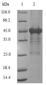 Recombinant Human Adenine phosphoribosyltransferase (APRT)