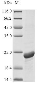 Recombinant Human Aquaporin-1 (AQP1), partial