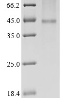 (Tris-Glycine gel) Discontinuous SDS-PAGE (reduced) with 5% enrichment gel and 15% separation gel.