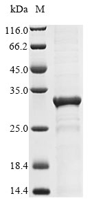 Recombinant Human AT-rich interactive domain-containing protein 4B (ARID4B), partial, Homo sapiens (Human), E.coli, N-terminal 6xHis-tagged, 32.8kDa, purity >85% as determined by SDS-PAGE.