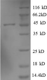 Recombinant Human ADP-ribosylation factor-like protein 2-binding protein (ARL2BP), Homo sapiens (Human), E.coli, N-terminal GST-tagged, 45.8kDa, purity >90% as determined by SDS-PAGE.