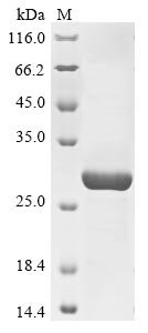 Recombinant Human Neutral ceramidase (ASAH2), partial