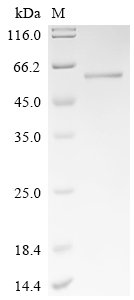 Recombinant Human Activating signal cointegrator 1 complex subunit 1 (ASCC1)