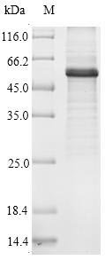 Recombinant Human Beclin 1-associated autophagy-related key regulator (ATG14)