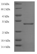 Recombinant Human ATP synthase subunit delta, mitochondrial (ATP5D), Homo sapiens (Human), E.coli, N-terminal 6xHis-SUMO-tagged, 31.0kDa, purity >90% as determined by SDS-PAGE.
