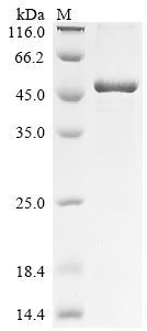 Recombinant Human Ataxin-7-like protein 3 (ATXN7L3), Homo sapiens (Human), E.coli, C-terminal 6xHis-tagged, 45.6kDa, purity >85% as determined by SDS-PAGE.