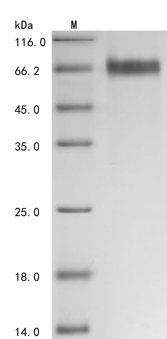 Recombinant Human Tyrosine-protein kinase receptor UFO (AXL), partial (Active), Homo sapiens (Human), Mammalian cell, C-terminal 10xHis-tagged, 48.9kDa, purity >95% as determined by SDS-PAGE.
