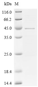 Recombinant Human UDP-GlcNAc:betaGal beta-1,3-N-acetylglucosaminyltransferase 5 (B3GNT5), partial, Homo sapiens (Human), E.coli, C-terminal 6xHis-tagged, 46.7kDa, purity >90% as determined by SDS-PAGE.