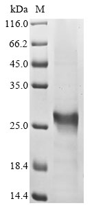 Recombinant Human Transcription regulator protein BACH2 (BACH2), partial, Homo sapiens (Human), E.coli, N-terminal 6xHis-tagged, 23.5kDa, purity >85% as determined by SDS-PAGE.