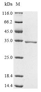 Recombinant Human B-cell CLL/lymphoma 9 protein (BCL9), partial, Homo sapiens (Human), E.coli, N-terminal 6xHis-tagged and C-terminal 6xHis-tagged, 26.7kDa, purity >85% as determined by SDS-PAGE.