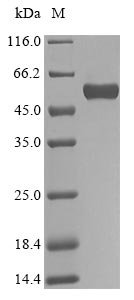 Recombinant Human Biglycan (BGN), Homo sapiens (Human), E.coli, N-terminal 10xHis-SUMO-tagged and C-terminal Myc-tagged, 57.2kDa, purity >90% as determined by SDS-PAGE.