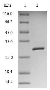 Recombinant Human Baculoviral IAP repeat-containing protein 5 (BIRC5)