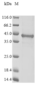 Recombinant Human BCL2/adenovirus E1B 19 kDa protein-interacting protein 3-like (BNIP3L), partial, Homo sapiens (Human), E.coli, N-terminal 10xHis-tagged and C-terminal Myc-tagged, 28.0kDa, purity >85% as determined by SDS-PAGE.